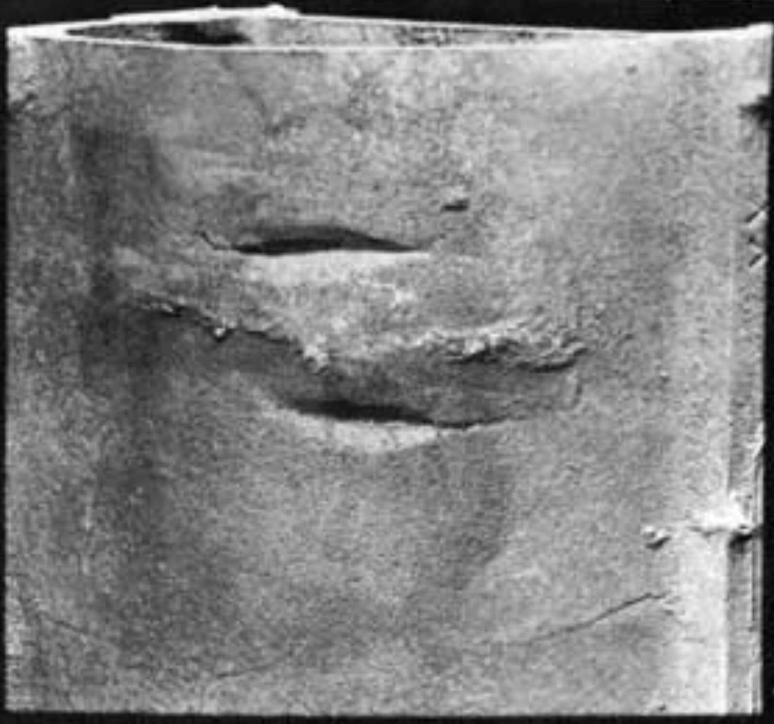 swells casting defects